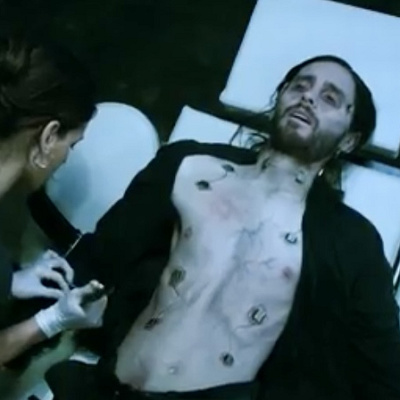 血清を投与するマイケル